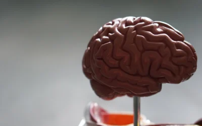 Why neurodivergence can give high-performing teams an edge